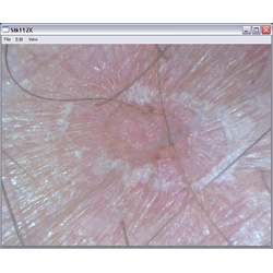 Visualizacin de la cicatrizacin de una herida con el microscopio PCE-MM 200.
