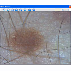Aqu� ve el microscopio USB PCE-MM 200 investigando la piel.