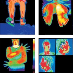 Comprobación de la temperatura del cuerpo humano con las camaras termograficas.