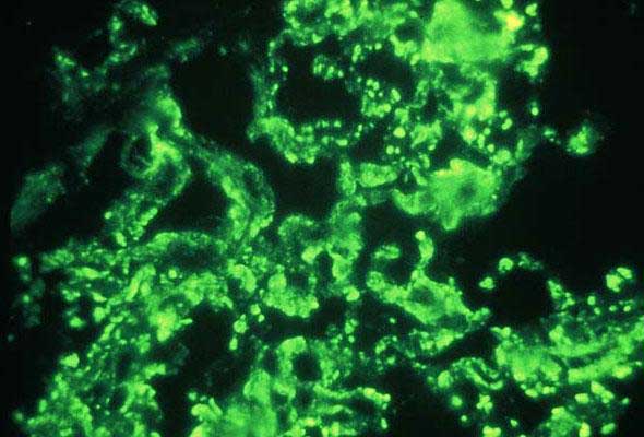 Imagen de una muestra no tratada con microscopio fluorescente