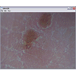 Visualizacin de un lunar con el microscopio PCE-MM 200.