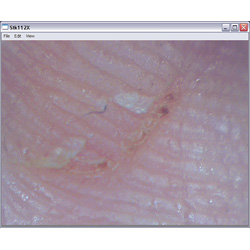 Visualización de la cicatrización de una herida con el microscopio PCE-MM 200.