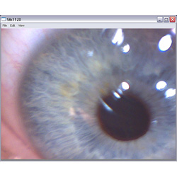 Visión de un ojo con el microscopio PCE-MM 200.