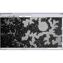 Aquí ve una imagen a 200 aumentos en blanco y negro
